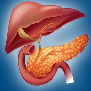 Pancreatitis cronica