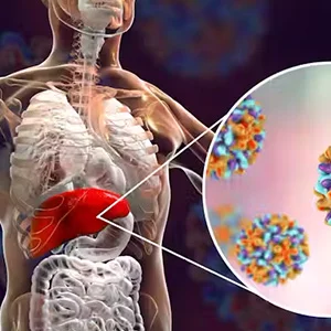 HBV Reactivation