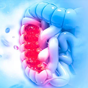 Screening de cancer de colon