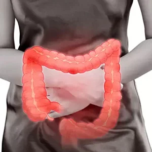 Abordaje terapéutico de colitis ulcerosa