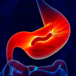 Helicobacter Pylori