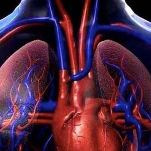 Read more about the article Hipertensión porto-pulmonar